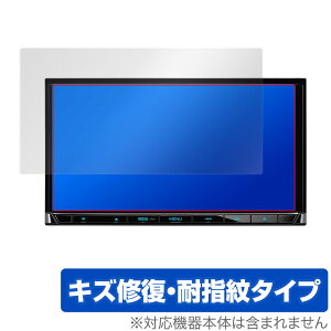 KENWOOD �ʑ��i�r MDV-S709 S708 S707 L308 D208 �ی� �t�B���� OverLay Magic for �P���E�b�h �J�[�i�r MDV-S709 �� �t���ی� �L�Y�C�� �ώw�� �h�w��