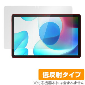 realme Pad 10.4 �ی� �t�B���� OverLay Plus for ���A���~�[ Pad 10.4�C���` �^�u���b�g �t���ی� �A���`�O���A �ᔽ�� ����� �h�w��