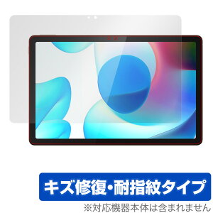 realme Pad 10.4 �ی� �t�B���� OverLay Magic for ���A���~�[ Pad 10.4�C���` �^�u���b�g �t���ی� �L�Y�C�� �ώw�� �h�w�� �R�[�e�B���O