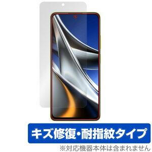 Xiaomi POCO X4 Pro 5G ی tB OverLay Magic for VI~[ X}[gtH |R X4 v 5G tی LYC ώw hw R[eBO