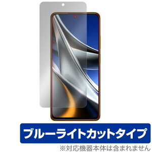 Xiaomi POCO X4 Pro 5G ی tB OverLay Eye Protector for VI~[ X}[gtH |R X4 v 5G tی ڂɂ₳ u[CgJbg