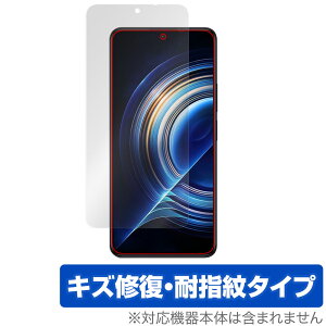 Xiaomi Redmi K50 Pro �ی� �t�B���� OverLay Magic for �V���I�~�[ �X�}�[�g�t�H�� ���h�~ K50 �v�� �t���ی� �L�Y�C�� �ώw�� �h�w�� �R�[�e�B���O