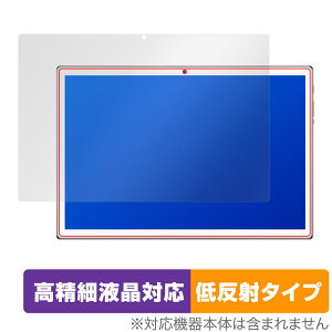 amulet7 10.1C` ^ubg^PC P10SUPlus (P10SU+) ی tB OverLay Plus Lite for amulet7 P10SUPlus ׉tΉ ᔽ  hw