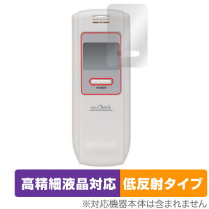 یtB I[d@ AR[eX^[ HB-A02-W OverLay Plus Lite for AR[`FbJ[ HBA02W tی ׉tΉ ᔽ  hw