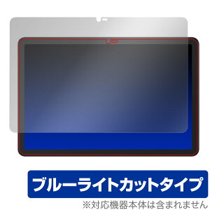 TCL NXTPAPER 10s ی tB OverLay Eye Protector for TCL ^ubg NXTPAPER10s tی ڂɂ₳ u[CgJbg
