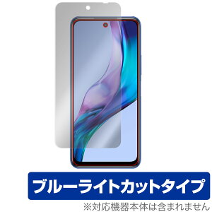 Xiaomi Redmi Note 10T ی tB OverLay Eye Protector for VI~[ h~ m[g 10T tی ڂɂ₳ u[CgJbg
