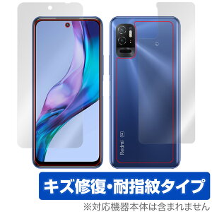 Xiaomi Redmi Note 10T \ w tB OverLay Magic for VI~[ h~ m[g 10T \ʁEwʃZbg LYC ώw hw R[eBO