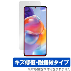 Xiaomi Redmi Note 11 Pro+ 5G ی tB OverLay Magic for VI~[ X}[gtH RedmiNote11Pro+5G tی LYC ώw hw
