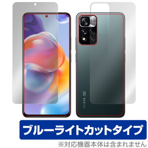 Xiaomi Redmi Note 11 Pro+ 5G \ w tB Zbg OverLay Eye Protector for VI~[ X}[gtH RedmiNote11Pro+5G u[CgJbg