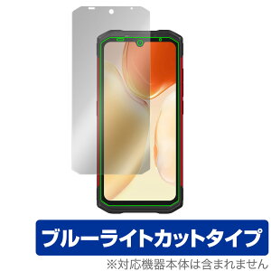 DOOGEE S98 ی tB OverLay Eye Protector for hD[W[ S98 X}[gtH tی ڂɂ₳ u[CgJbg