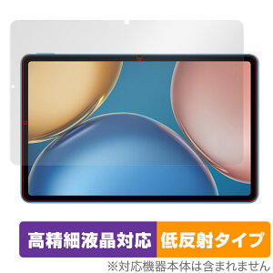Honor Pad V7 �ی� �t�B���� OverLay Plus Lite for Honor Pad V7 �^�u���b�g �t���ی� �����׉t���Ή� �A���`�O���A �ᔽ�� ����� �h�w��
