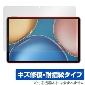 Honor Pad V7 �ی� �t�B���� OverLay Magic for Honor Pad V7 �^�u���b�g �t���ی� �L�Y�C�� �ώw�� �h�w�� �R�[�e�B���O