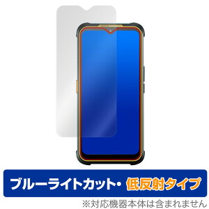 AGM Glory G1S �ی� �t�B���� OverLay Eye Protector �ᔽ�� for AGM �X�}�[�g�t�H�� Glory G1S �t���ی� �u���[���C�g�J�b�g ���˒ጸ