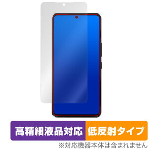 AQUOS R7 SH-52C A101SH ی tB OverLay Plus Lite for V[v ANIX R7 tی ׉tΉᔽ  hw