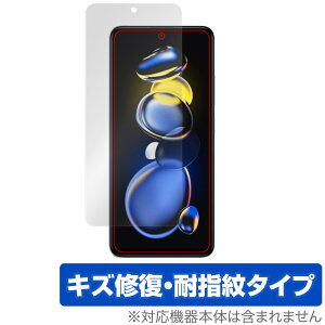 Xiaomi Redmi Note 11T Pro ی tB OverLay Magic for VI~ h~ m[g 11T v tی C ώw wh~