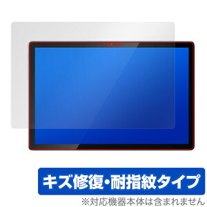 Blackview Tab 12 ی tB OverLay Magic for ubNr[ ^ubg tی C ώw wh~ R[eBO