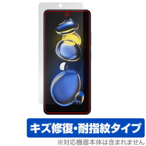 Xiaomi Redmi Note 11T Pro{ ی tB OverLay Magic for VI~ h~ m[g 11T v{ tی C ώw wh~