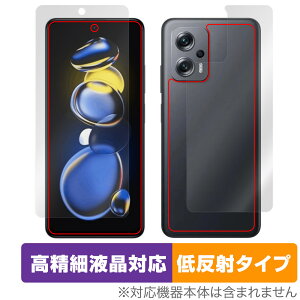 Xiaomi Redmi Note 11T Pro+ 表面 背面 フィルム セット OverLay Plus Lite for シャオミ レドミノート 11Tプロ+ アンチグレア 反射防止
