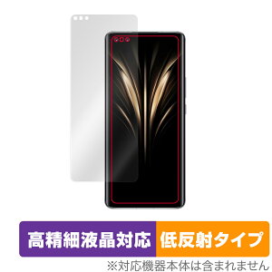 Honor Magic4 Ultimate �ی� �t�B���� OverLay Plus Lite for �I�i�[ �X�}�[�g�t�H�� �}�W�b�N 4 �����׉t���Ή� �A���`�O���A ���˖h�~