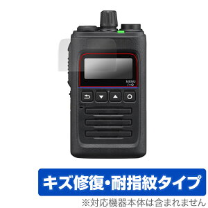 KENWOOD �f�W�^���g�����V�[�o�[ TPZ-D563BTE TPZ-D563E TPZ-D563BT TPZ-D563 �ی� �t�B���� OverLay Magic �t���ی� ���C�� �w��h�~