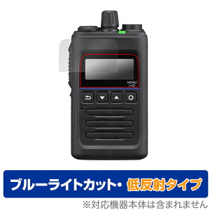 KENWOOD �f�W�^���g�����V�[�o�[ TPZ-D563BTE TPZ-D563E TPZ-D563BT TPZ-D563 �ی� �t�B���� OverLay Eye Protector �ᔽ�� �u���[���C�g