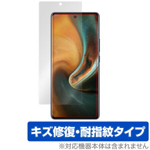 vivo x80 pro �ی� �t�B���� OverLay Magic for ���B�[���H �X�}�[�g�t�H�� x80 �v�� �t���ی� ���C�� �ώw�� �w��h�~ �R�[�e�B���O