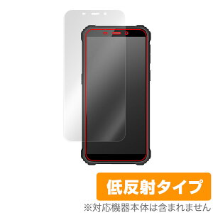 OUKITEL WP20 �ی� �t�B���� OverLay Plus for �I�E�L�e�� �X�}�[�g�t�H�� WP20 �t���ی� �A���`�O���A ���˖h�~ ����� �w��h�~