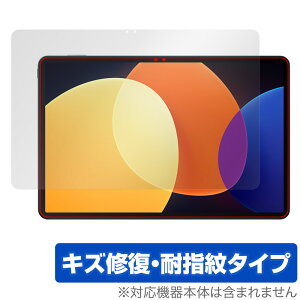 Xiaomi Pad 5 Pro 12.4 �ی� �t�B���� OverLay Magic for �V���I�~�[ �p�b�h 5 �v�� �t���ی� ���C�� �ώw�� �w��h�~ �R�[�e�B���O