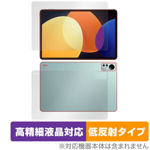 Xiaomi Pad 5 Pro 12.4 �\�� �w�� �t�B���� �Z�b�g OverLay Plus Lite for �V���I�~�[ �p�b�h 5 �v�� �����׉t�� �A���`�O���A ���˖h�~
