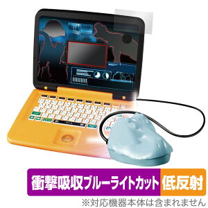 WVbNE[h }EXŃX^fBp\R ی tB OverLay Absorber ᔽ ^Jg~[ Ռz ˖h~ R