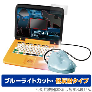 WVbNE[h }EXŃX^fBp\R ی tB OverLay Eye Protector ᔽ u[CgJbg ˖h~