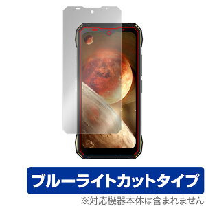 DOOGEE S89 Pro �ی� �t�B���� OverLay Eye Protector for �h�D�[�W�[ �X�}�[�g�t�H�� S89 Pro �t���ی� �ڂɗD���� �u���[���C�g�J�b�g