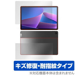 Lenovo Tab M10 Plus 3rd Gen �\�� �w�� �t�B���� OverLay Magic for LenovoTab M10 Plus Gen3 �\�ʁE�w�ʃZ�b�g ���C�� �ώw�� �w��h�~