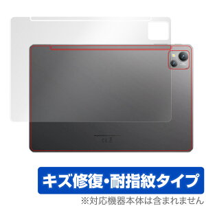 Blackview Tab 13 w ی tB OverLay Magic for ubNr[ ^ubg Tab13 {̕یtB C wh~