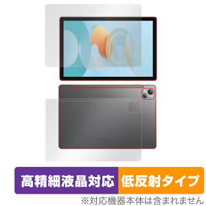 Blackview Tab 13 �\�� �w�� �t�B���� �Z�b�g OverLay Plus Lite �u���b�N�r���[ �^�u���b�g Tab13 �����׉t���Ή� �A���`�O���A ���˖h�~