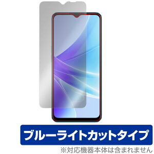 OPPO A77  ی tB OverLay Eye Protector for Ib| X}[gtH A77 tی ڂɗD u[CgJbg
