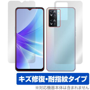 OPPO A77 ������ �\�� �w�� �t�B���� OverLay Magic for �I�b�| �X�}�[�g�t�H�� A77 �\�ʁE�w�ʃZ�b�g ���C�� �ώw�� �w��h�~