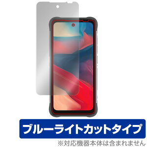 UMIDIGI BISON GT2 �ی� �t�B���� OverLay Eye Protector for ���~�f�B�W �X�}�z BISONGT2 �t���ی� �ڂɗD���� �u���[���C�g�J�b�g