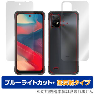 UMIDIGI BISON GT2 \ w tB Zbg OverLay Eye Protector ᔽ ~fBW X}z BISONGT2 u[CgJbg ˖h~