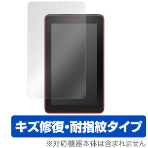 Fire ^ubg یtB OverLay Magic for Fire ^ubg t ی tB V[g V[ LYC ώw hw R[eBO ^ubg tB ~rbNX