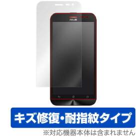 ASUS ZenFone 2 Laser (ZE500KL) 保護フィルム OverLay Magic for ASUS ZenFone 2 Laser (ZE500KL) 液晶 保護 フィルム シート シール キズ修復 耐指紋 防指紋 コーティング スマホフィルム おすすめ ミヤビックス