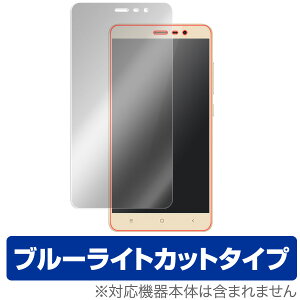 Xiaomi Redmi Note 3 یtB OverLay Eye Protector for Xiaomi Redmi Note 3 t ی tB VI~ ڂɂ₳ u[Cg Jbg X}ztB  ~rbNX