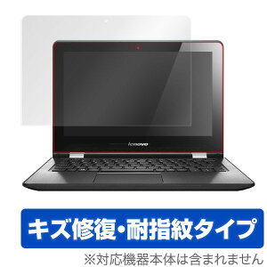 Lenovo YOGA 300 (11.6�^) �ی�t�B���� OverLay Magic for Lenovo YOGA 300 (11.6�^) �t�� �ی� �t�B���� �V�[�g �V�[�� �L�Y�C�� �ώw�� �h�w�� �R�[�e�B���O �^�u���b�g �t�B���� �~���r�b�N�X