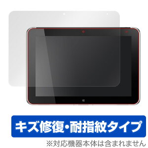 HP ElitePad 1000 G2 �ی�t�B���� OverLay Magic for HP ElitePad 1000 G2 �t�� �ی� �t�B���� �V�[�g �V�[�� �t�B���^�[ �L�Y�C�� �ώw�� �h�w�� �R�[�e�B���O �^�u���b�g �t�B���� �~���r�b�N�X