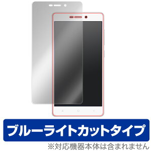 Xiaomi Redmi 3 یtB OverLay Eye Protector for Xiaomi Redmi 3 t ی tB V[g V[ tB^[ ڂɂ₳ u[Cg Jbg X}ztB  ~rbNX