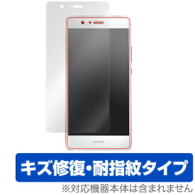 HUAWEI P9 lite PREMIUM / P9 lite 保護フィルム OverLay Magic for HUAWEI P9 lite PREMIUM / P9 lite 液晶 シート シール フィルター キズ修復 耐指紋 防指紋 コーティング スマホフィルム おすすめ ミヤビックス