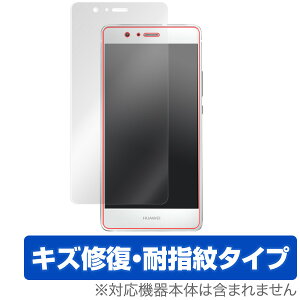 HUAWEI P9 lite PREMIUM / P9 lite �ی�t�B���� OverLay Magic for HUAWEI P9 lite PREMIUM / P9 lite �t�� �V�[�g �V�[�� �t�B���^�[ �L�Y�C�� �ώw�� �h�w�� �R�[�e�B���O �X�}�z�t�B���� �������� �~���r�b�N�X
