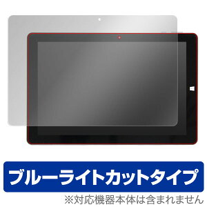 KNWL10K2-SR یtB OverLay Eye Protector for Wup PC^ubgg܎܋LOfh KNWL10K2-SRt ی tB V[g V[ tB^[ ڂɂ₳ u[CgJbg tB