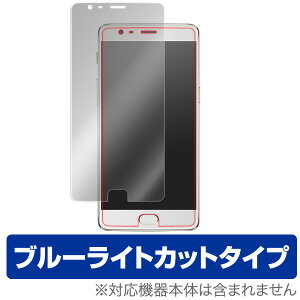 OnePlus 3T / OnePlus 3 یtB OverLay Eye Protector for OnePlus 3T / OnePlus 3t ی tB V[g V[ tB^[ ڂɂ₳ u[Cg Jbg X}ztB  ~rbNX