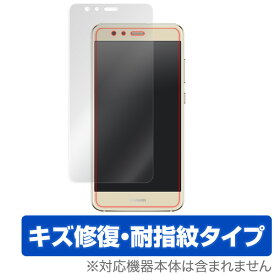 HUAWEI P10 Lite 保護フィルム OverLay Magic for HUAWEI P10 Lite 表面用保護シート液晶 保護 フィルム シート シール フィルター キズ修復 耐指紋 防指紋 コーティング スマホフィルム おすすめ ミヤビックス